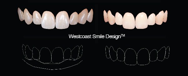 Cosmetic Dentistry Westcoast