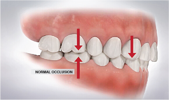 Image result for Dental occlusion