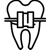 Dental Braces