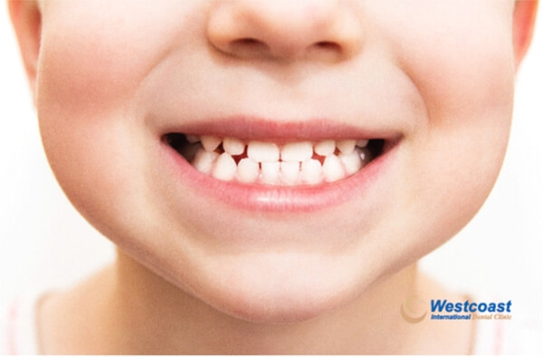 Baby Teeth/ Primary teeth