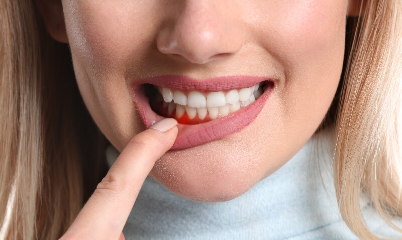Toothache Dental Consultation