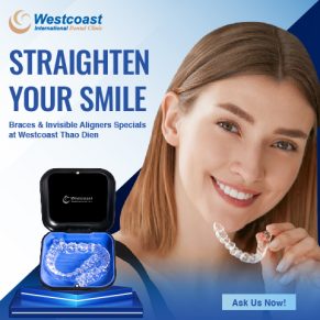 Crossbanner Westcoast Aligners