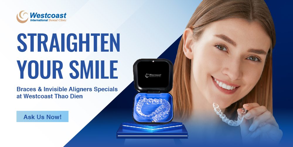 Popup Westcoast Aligners