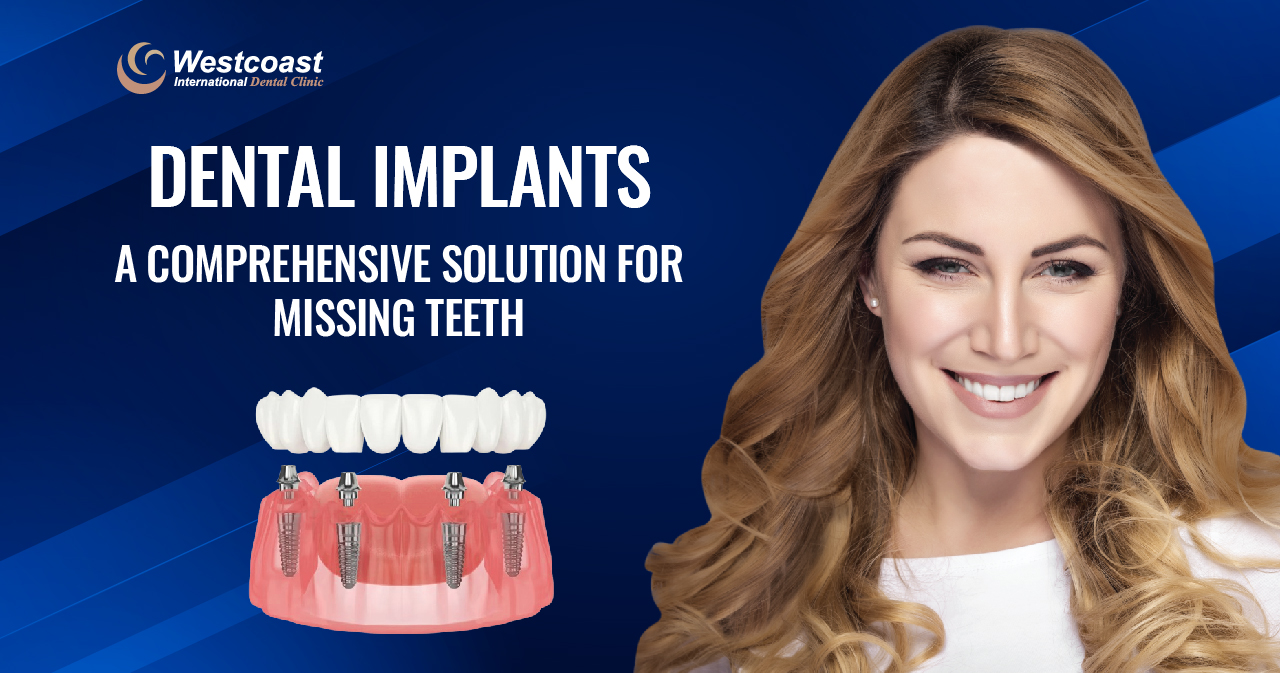 Dental Implants: A Comprehensive Solution for Missing Teeth