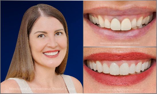 Print BF AT Desktop 1