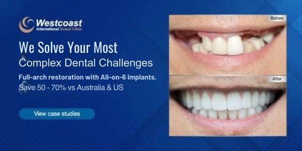 We Solve Your Most Complex Dental Challenges Full-arch restoration with All-on-6 implants. Save up to 50 - 70% vs Australia & US